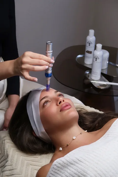 Microneedling mit dem Pen an der Stirn